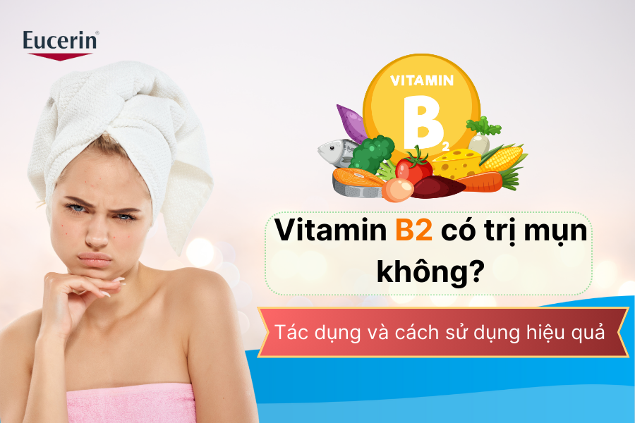 Vitamin B2 có trị mụn không 